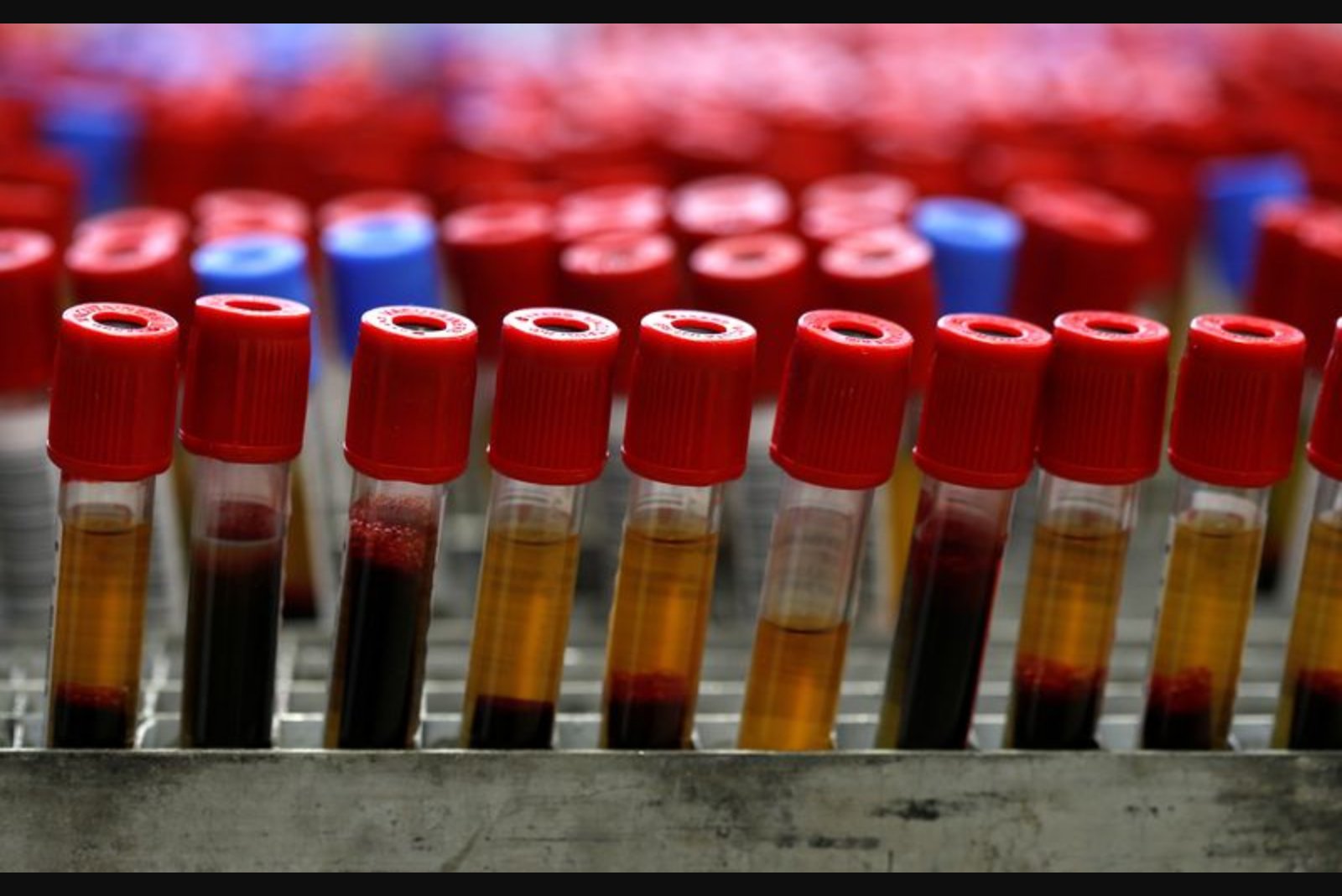 Agilent Announces $950 Million Cash Purchase of Biocare Medical