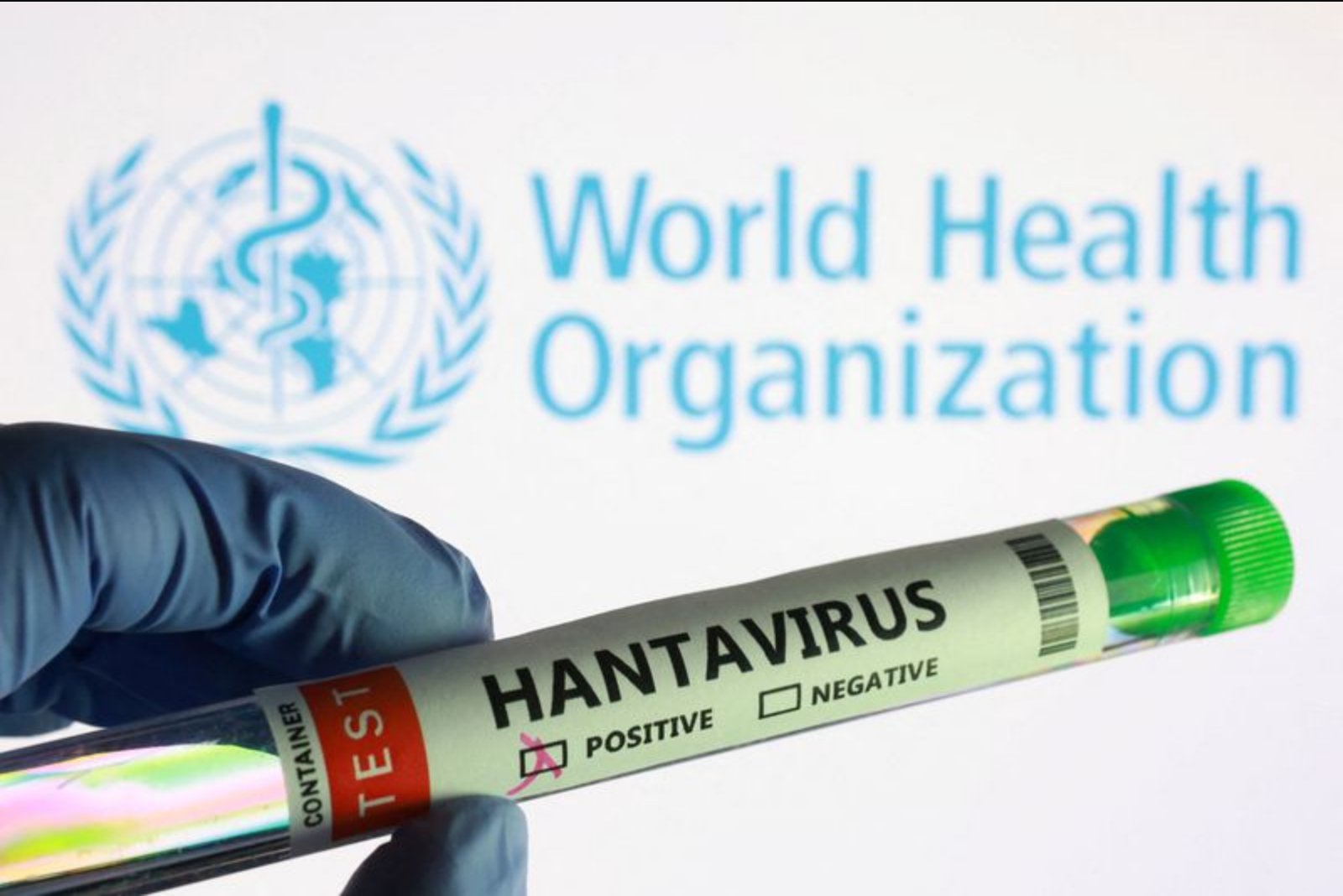 WHO Rushes to Draft Protocols as First Ship-Borne Andes Hantavirus Outbreak Approaches Tenerife