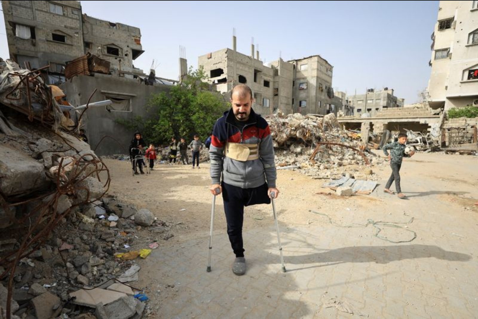 Gaza’s Amputees Face Severe Shortage of Prosthetic Supplies Amid Import Restrictions